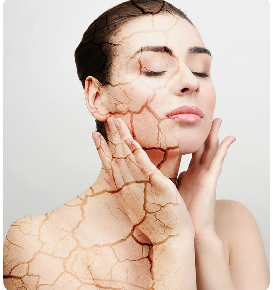 Dry Skin Care: Best Skincare for Dry Skin with Glowessiantials