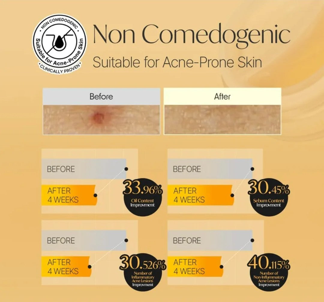 d’Alba Face Cream – Customizable Moisturizer for Acne-Prone & Oily Skin