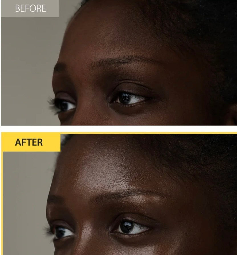“Close-up of model applying d’Alba face serum – suitable for all skin tones and types”