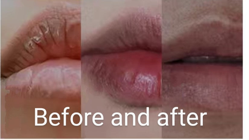 Before and after using DADR Lip Balm – visibly smoother and more hydrated lips