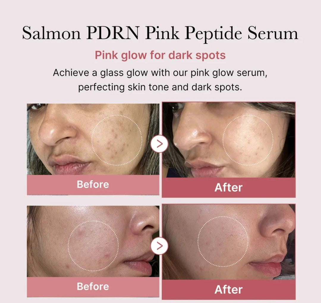 Before and after effects of Salmon PDRN Pink Peptide Serum on skin with dark spots.