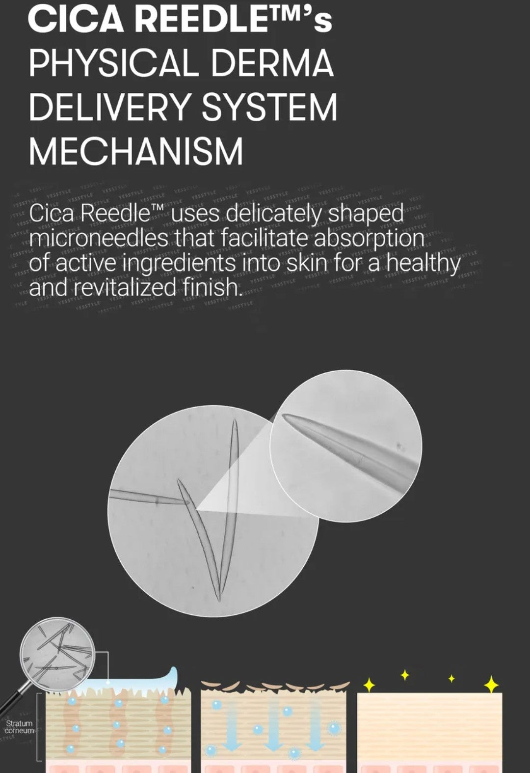 Diagram of Cica Reedle's physical derma delivery system mechanism on a black background.