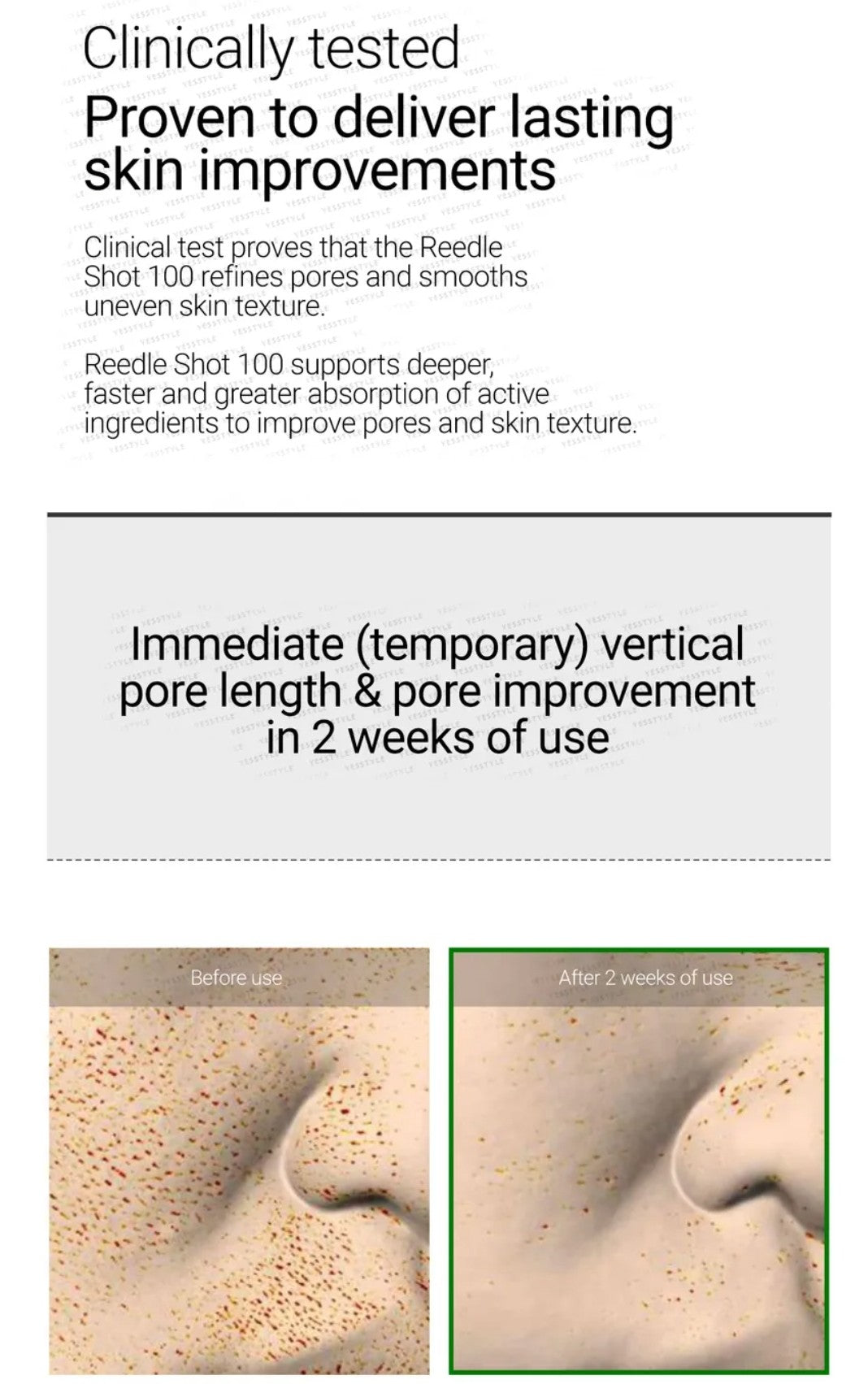 Advertisement for a skincare product showing before and after effects on skin texture.
