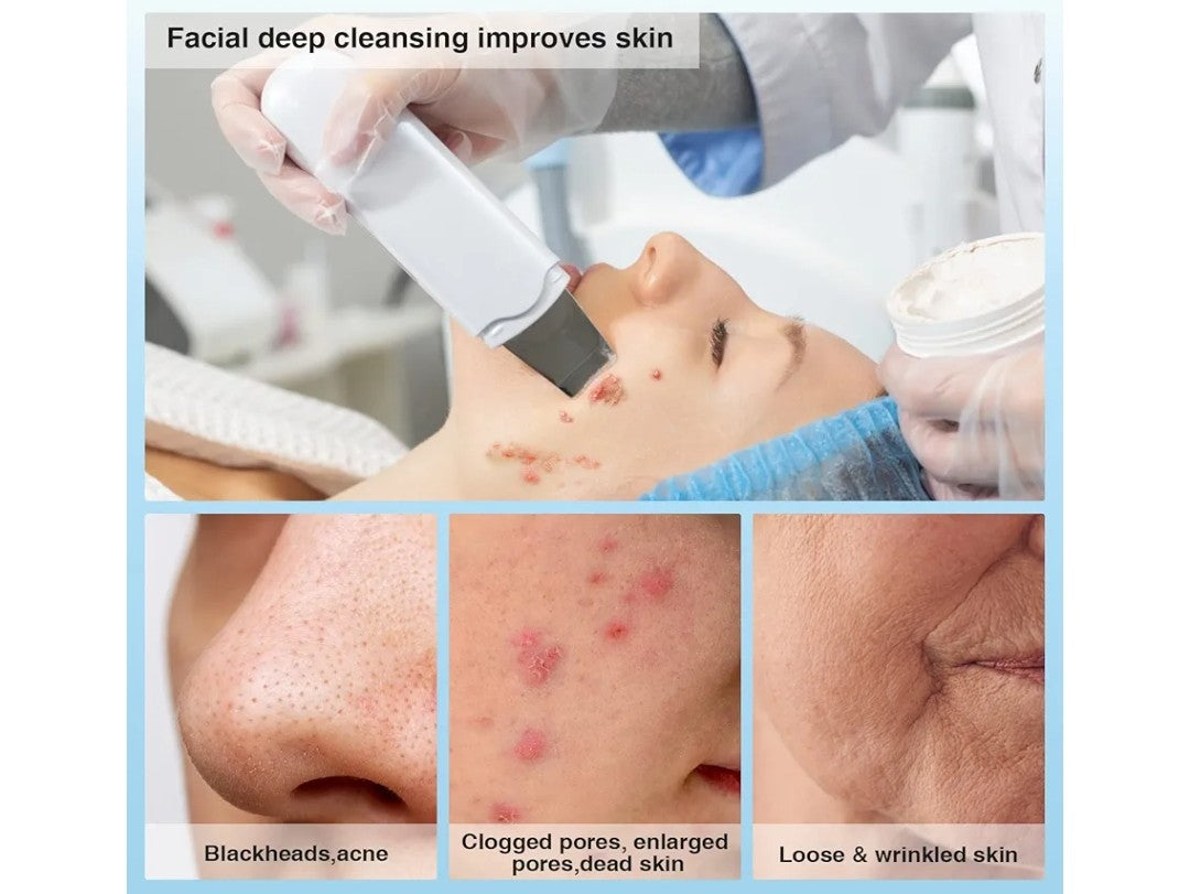 Facial deep cleansing process with close-up of skin issues and improvement.