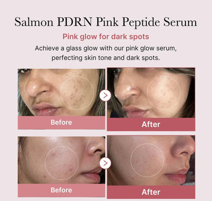Before and after effects of Salmon PDRN Pink Peptide Serum on skin with dark spots.