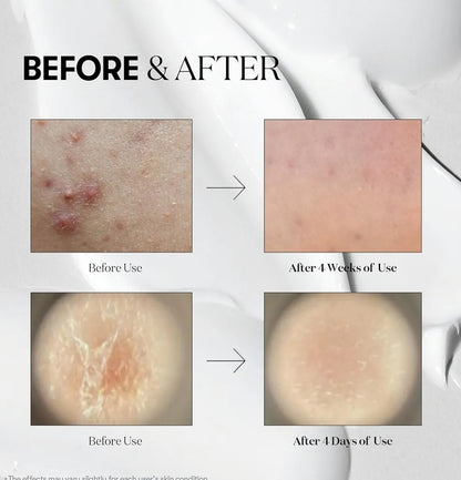 Before and after skin treatment results showing improvement over time.