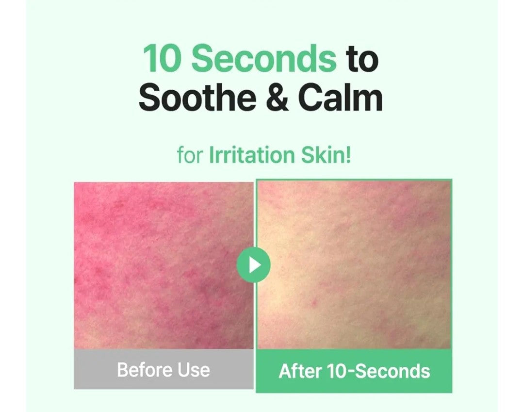 Before and after effect of a skin care product on irritated skin with text '10 Seconds to Soothe & Calm'.
