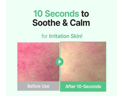 Before and after effect of a skin care product on irritated skin with text '10 Seconds to Soothe & Calm'.