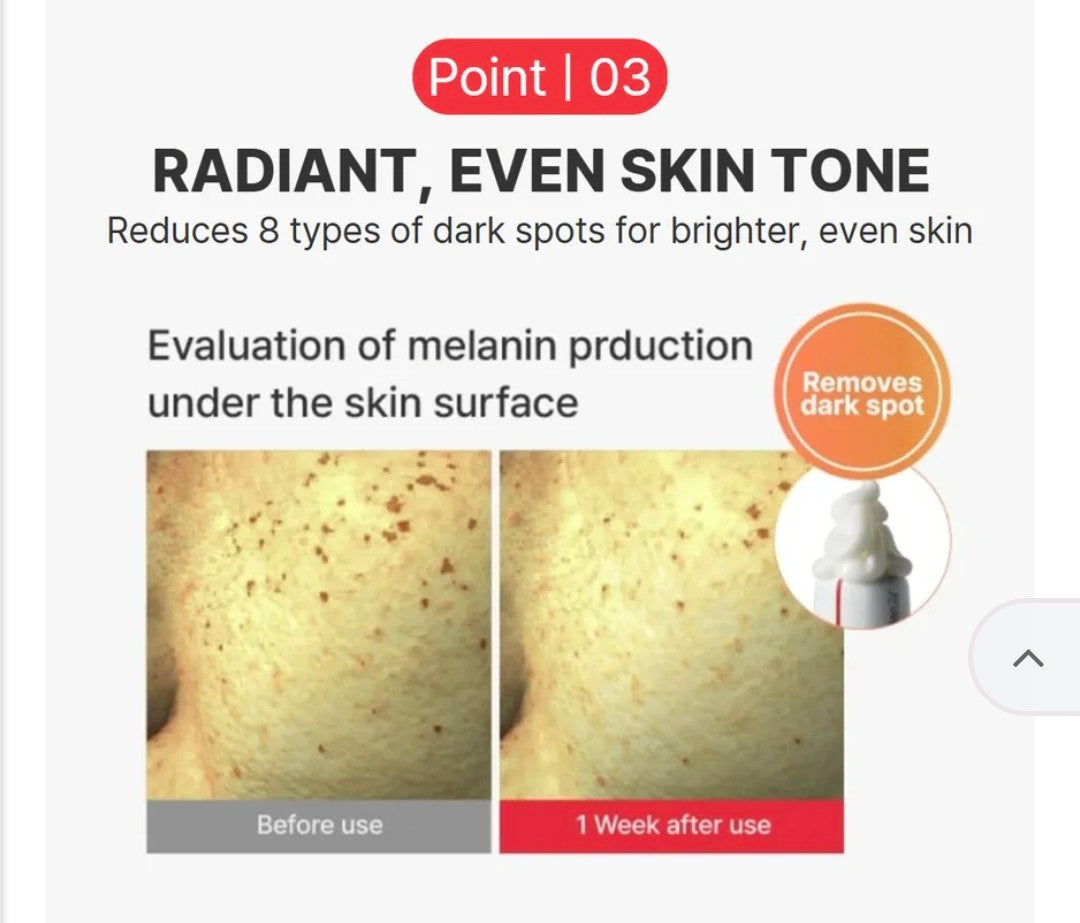 Advertisement showing before and after effects of a skin treatment on skin tone.