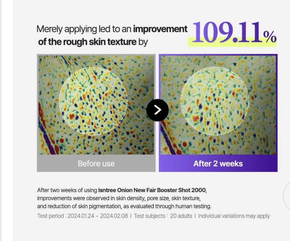 Before and after comparison of skin texture improvement with a 109.11% increase, using a product labeled 'Istree Onion New Fair Booster Shot 2000'.